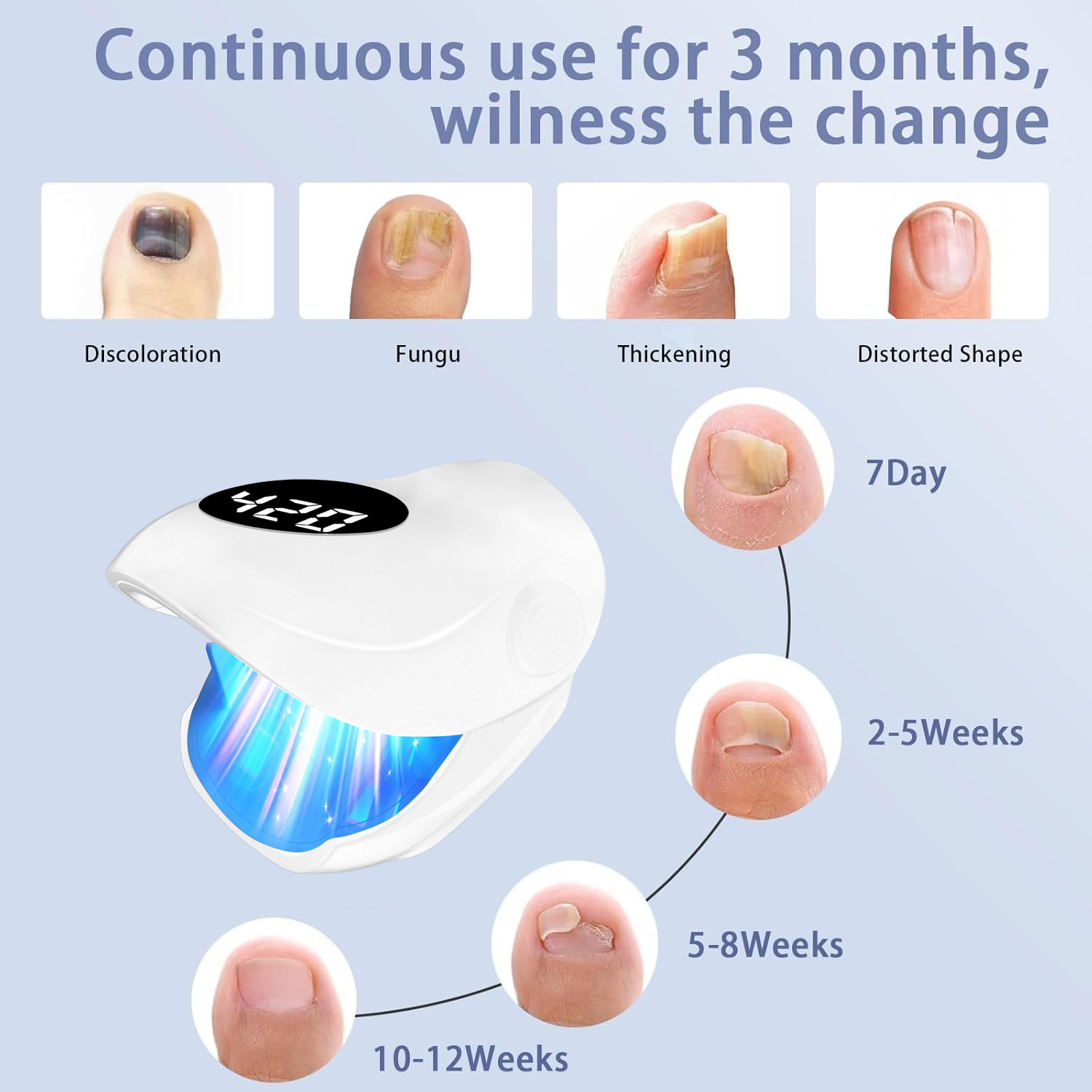 Laser do leczenia grzybicy paz – Galvanic Skin Sensor recenzja i cena